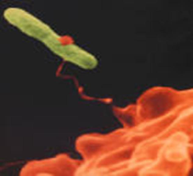 bakterie Legionelly